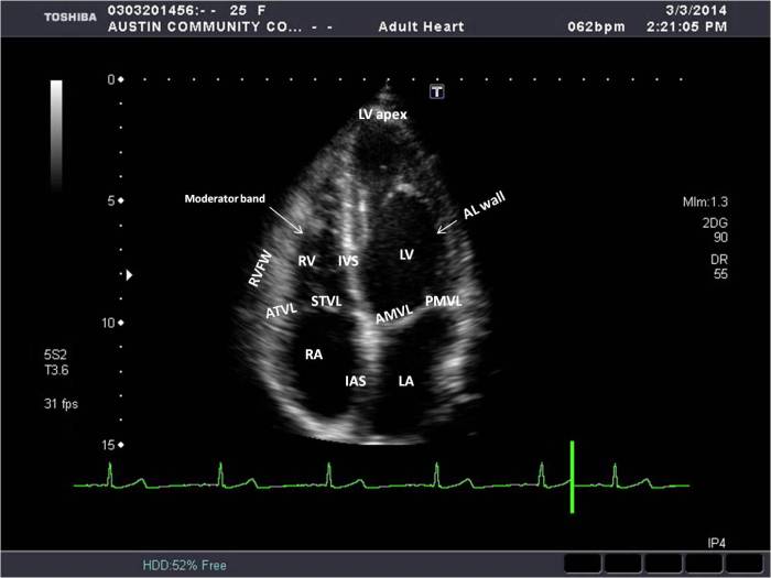 Ultrasound cardiac anatomy fullsize