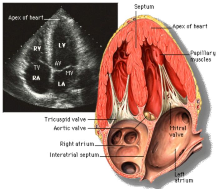 Apical 5 chamber view labeled